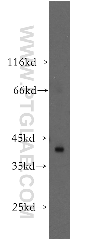 RAD51L1 Polyclonal antibody