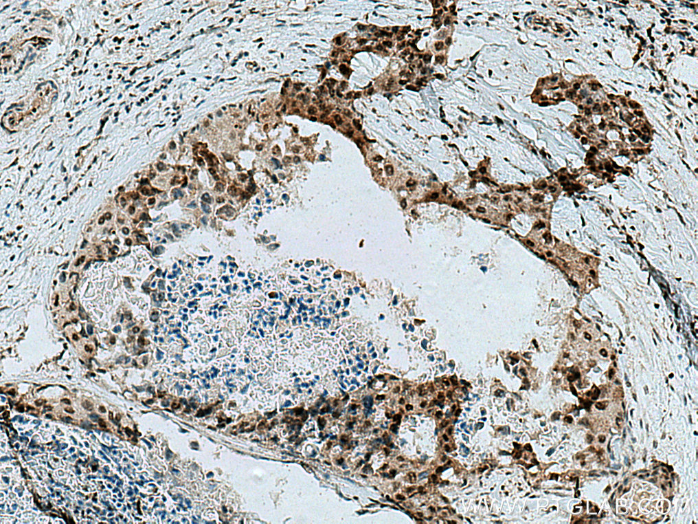 PNKP Polyclonal antibody