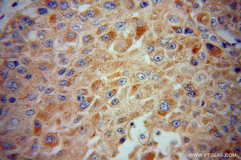 CYP2J2 Polyclonal antibody