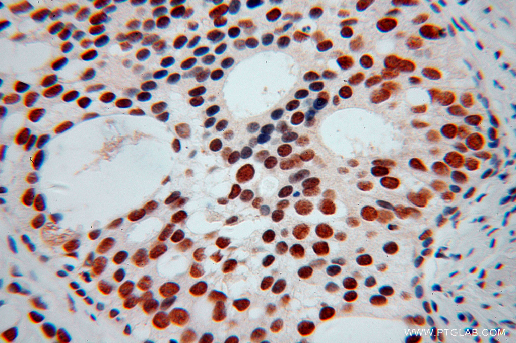 KHDRBS3 Polyclonal antibody