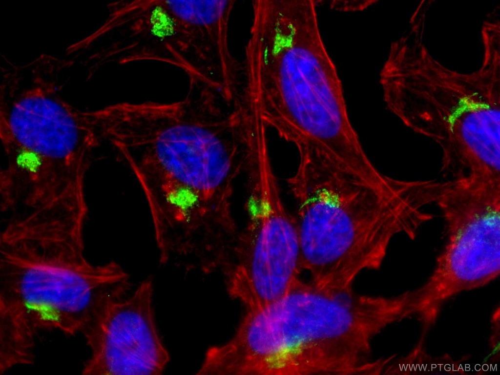 TGN46 Polyclonal antibody