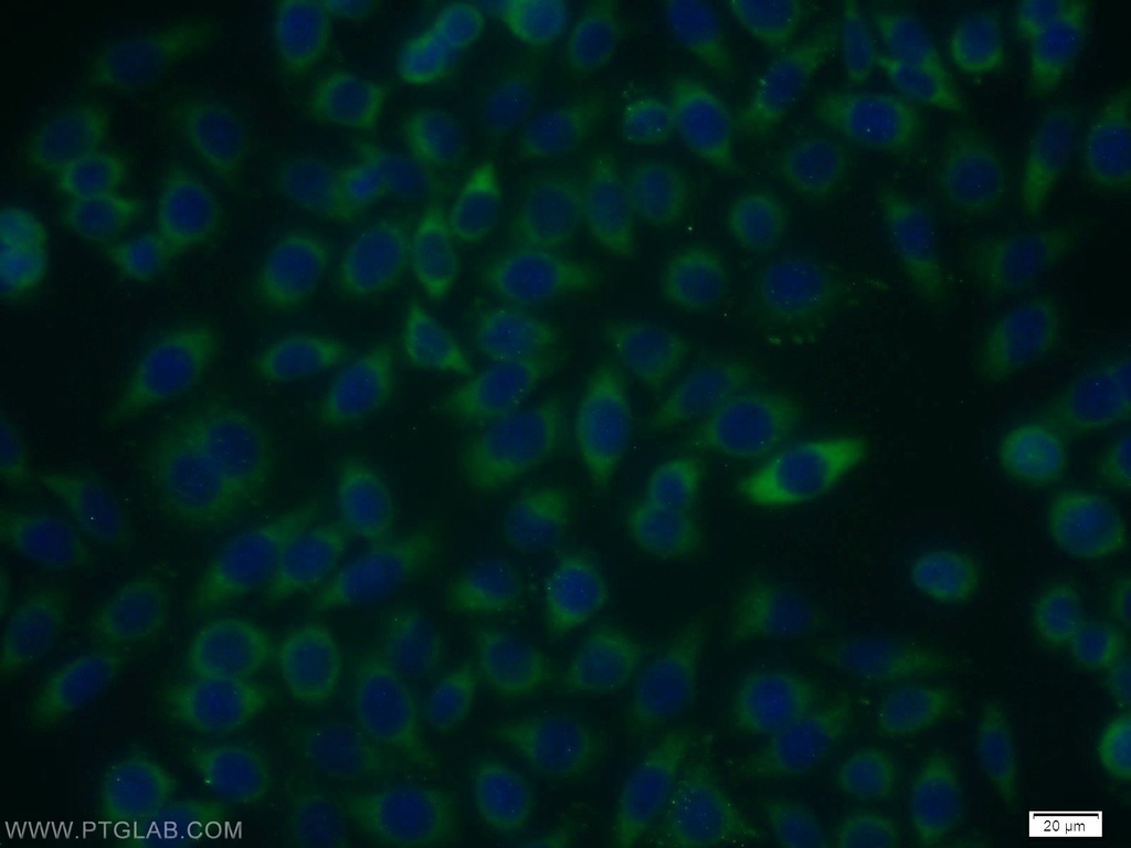 RIOK3 Polyclonal antibody