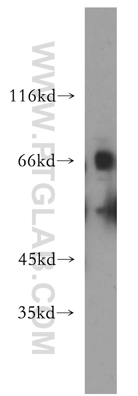 SLC22A2 Polyclonal antibody