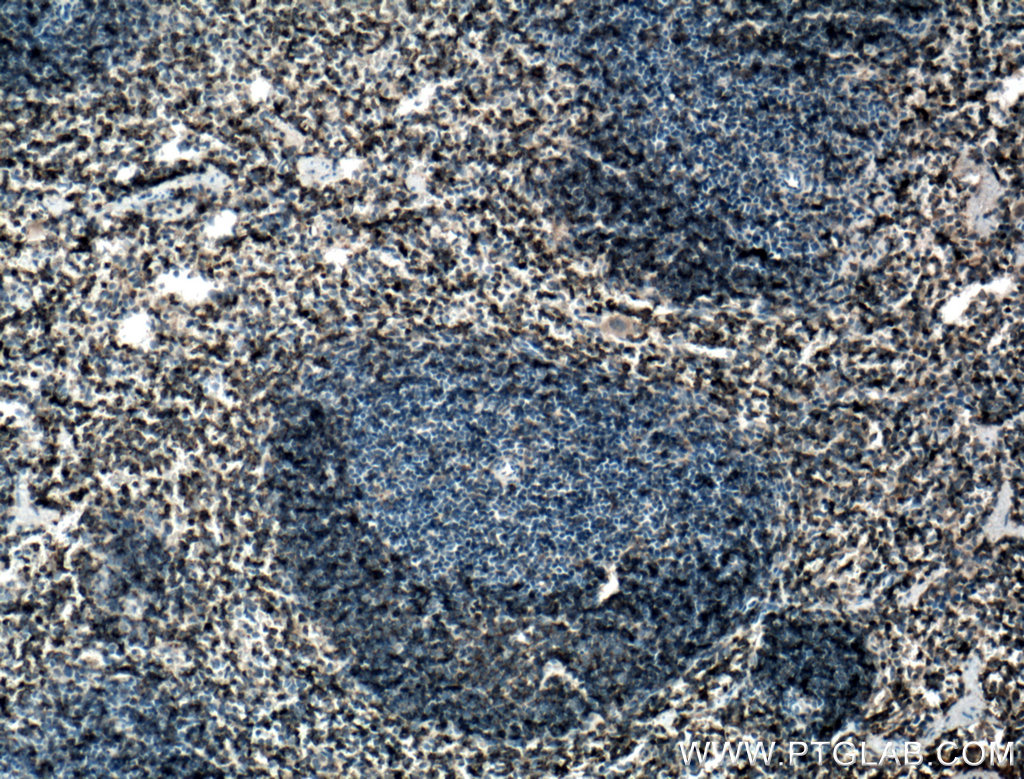 CD122/IL-2RB Polyclonal antibody