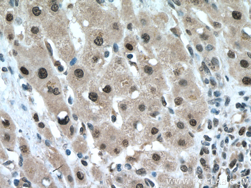 FBXO22 Polyclonal antibody