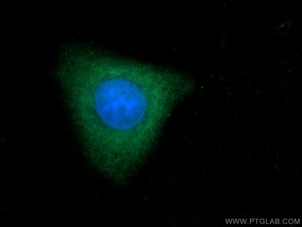 TOB2 Polyclonal antibody