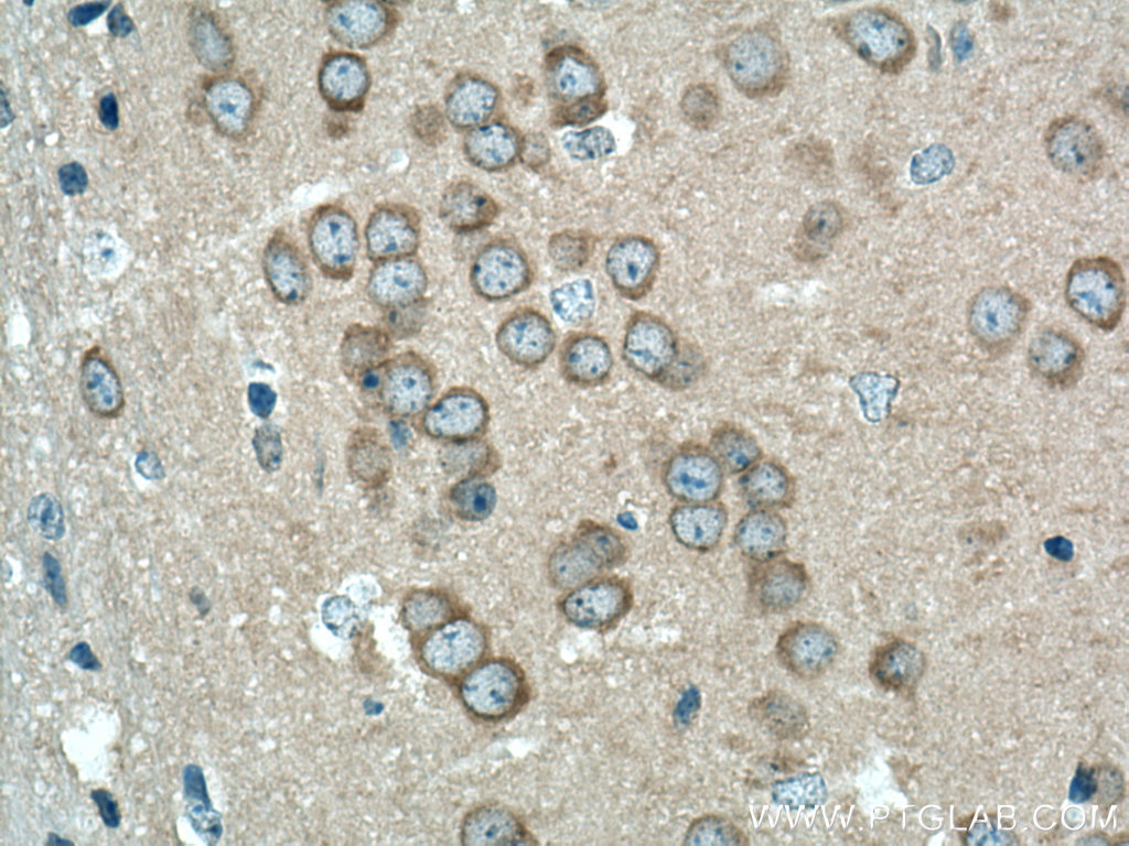 CAMK1D Polyclonal antibody