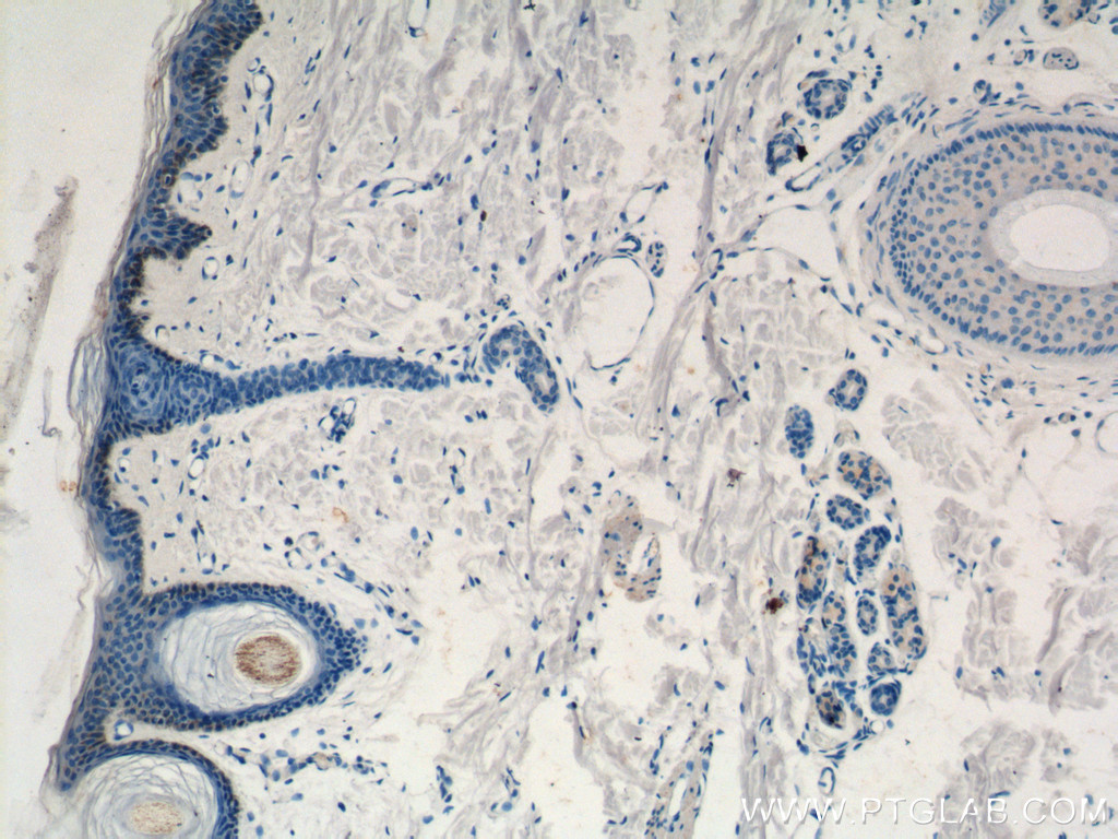 ST3GAL2 Polyclonal antibody