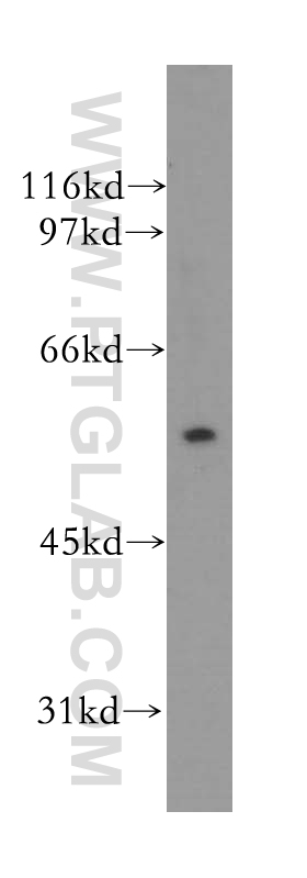 TRIM15 Polyclonal antibody