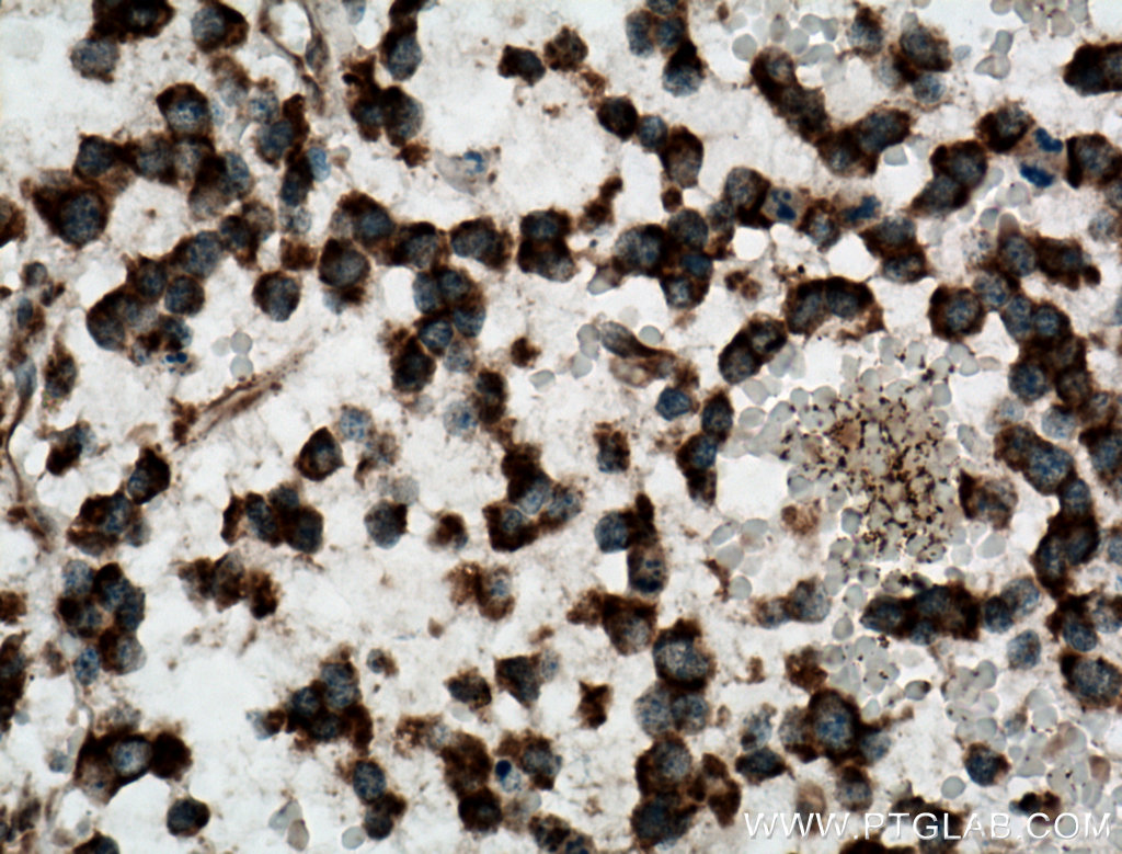 CAMKK1 Polyclonal antibody