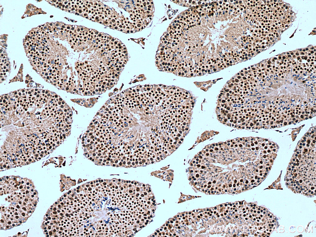 NSMCE2 Polyclonal antibody