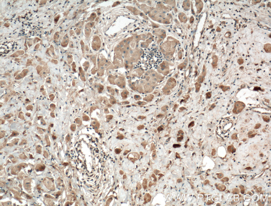RALA Polyclonal antibody