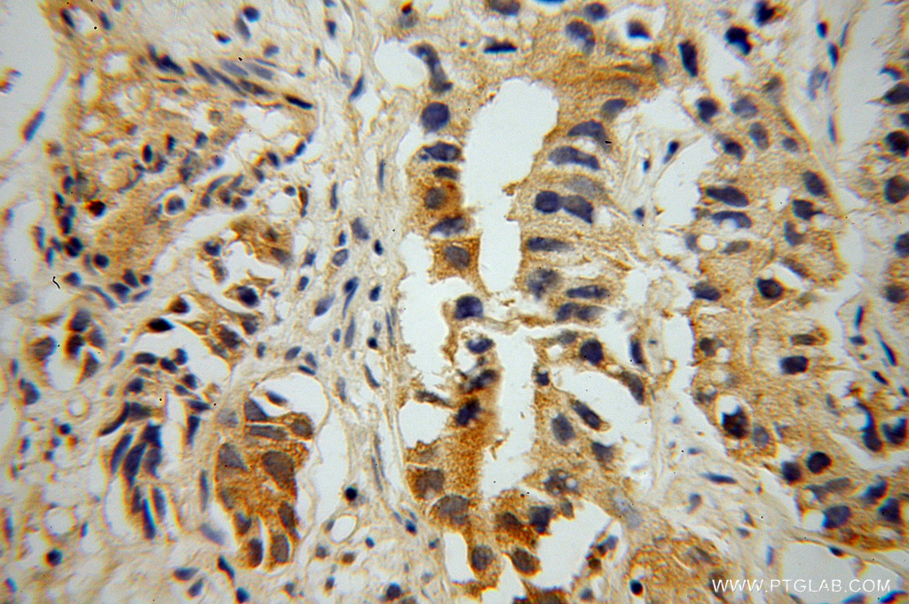 PNMA1 Polyclonal antibody