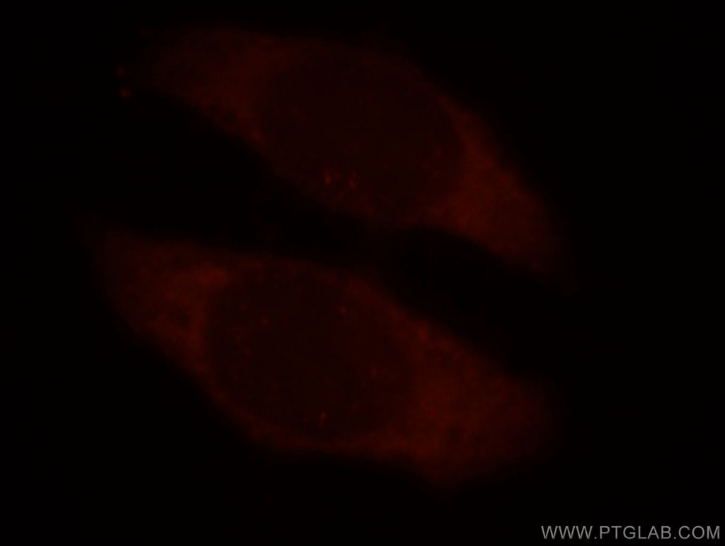 TROAP Polyclonal antibody