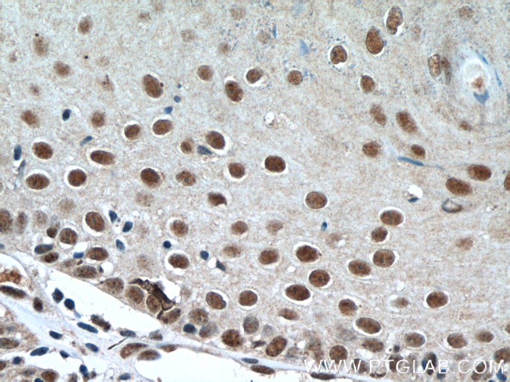 DSS1 Polyclonal antibody