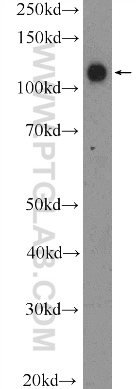 PCDH1 Polyclonal antibody