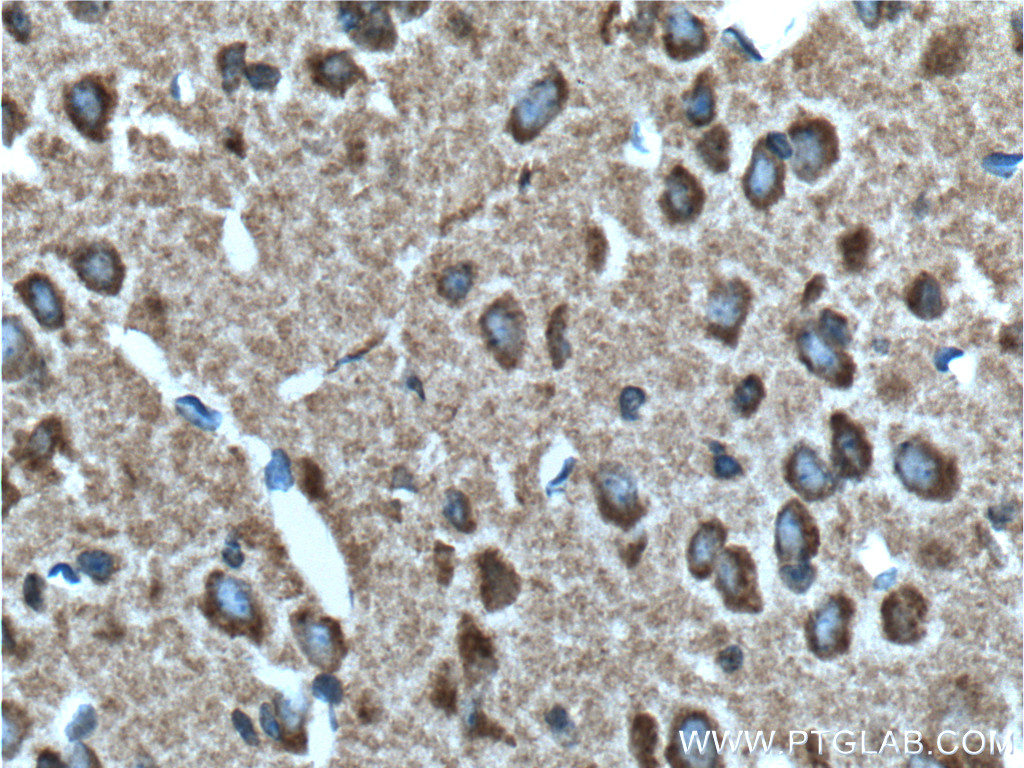 Syntaphilin Polyclonal antibody