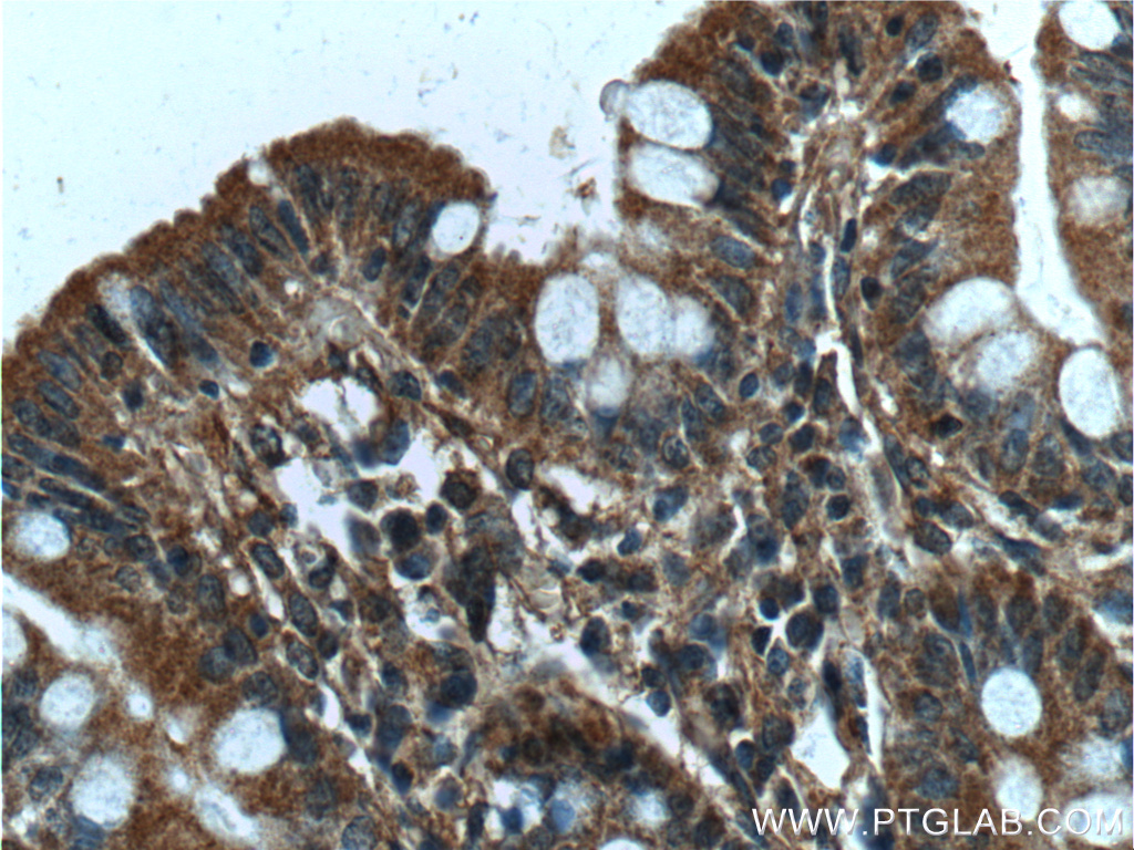 NARFL Polyclonal antibody