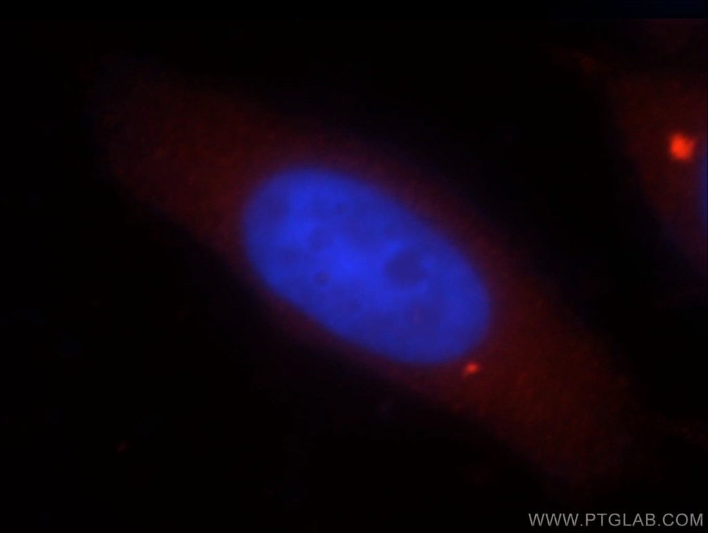 DNASE1L1 Polyclonal antibody