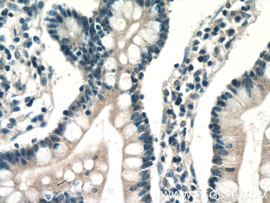 ENTPD2 Polyclonal antibody