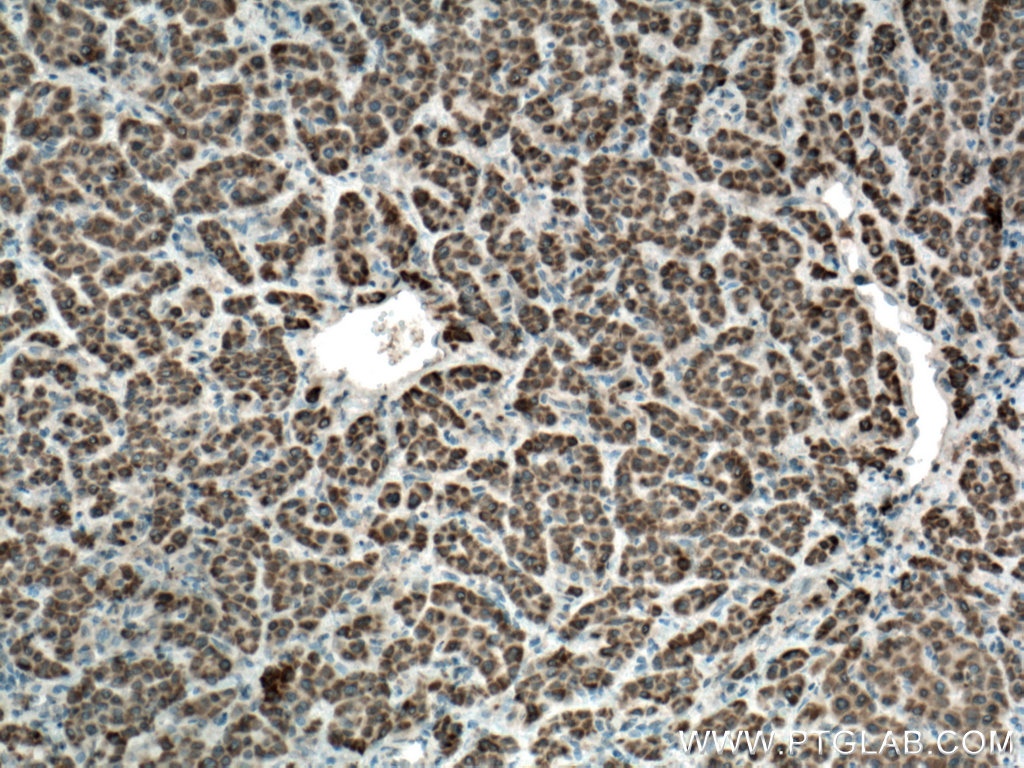 SLC35A2 Polyclonal antibody