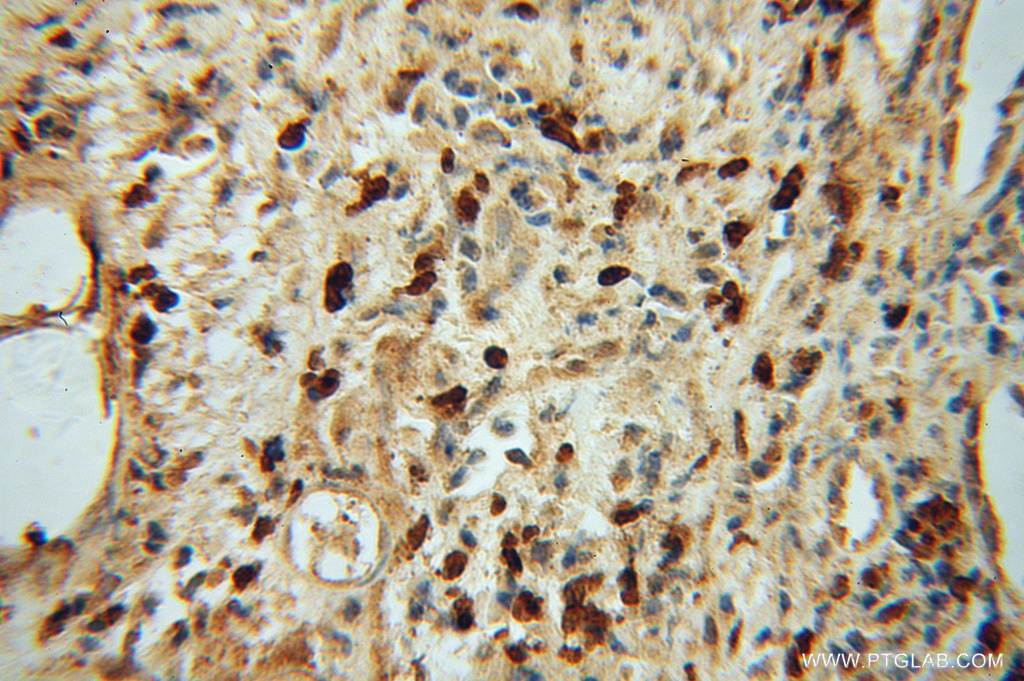 NR2C1 Polyclonal antibody