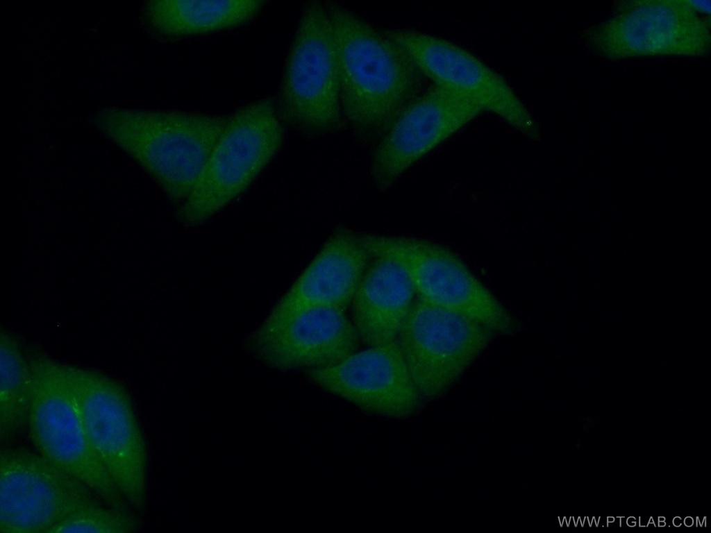 GART Polyclonal antibody