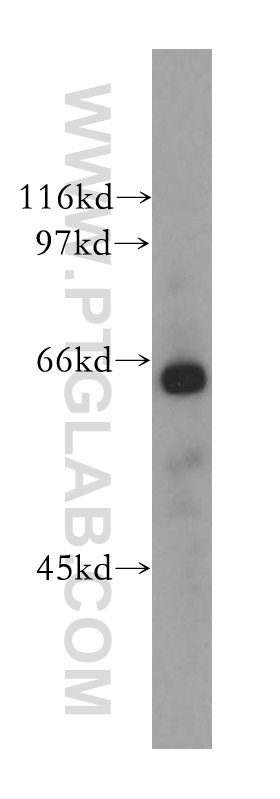 CDC14A Polyclonal antibody
