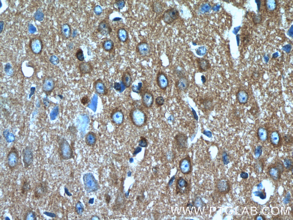 CRMP4 Polyclonal antibody