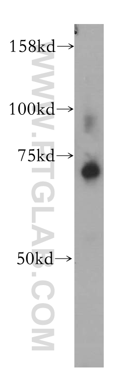 ZNF443 Polyclonal antibody