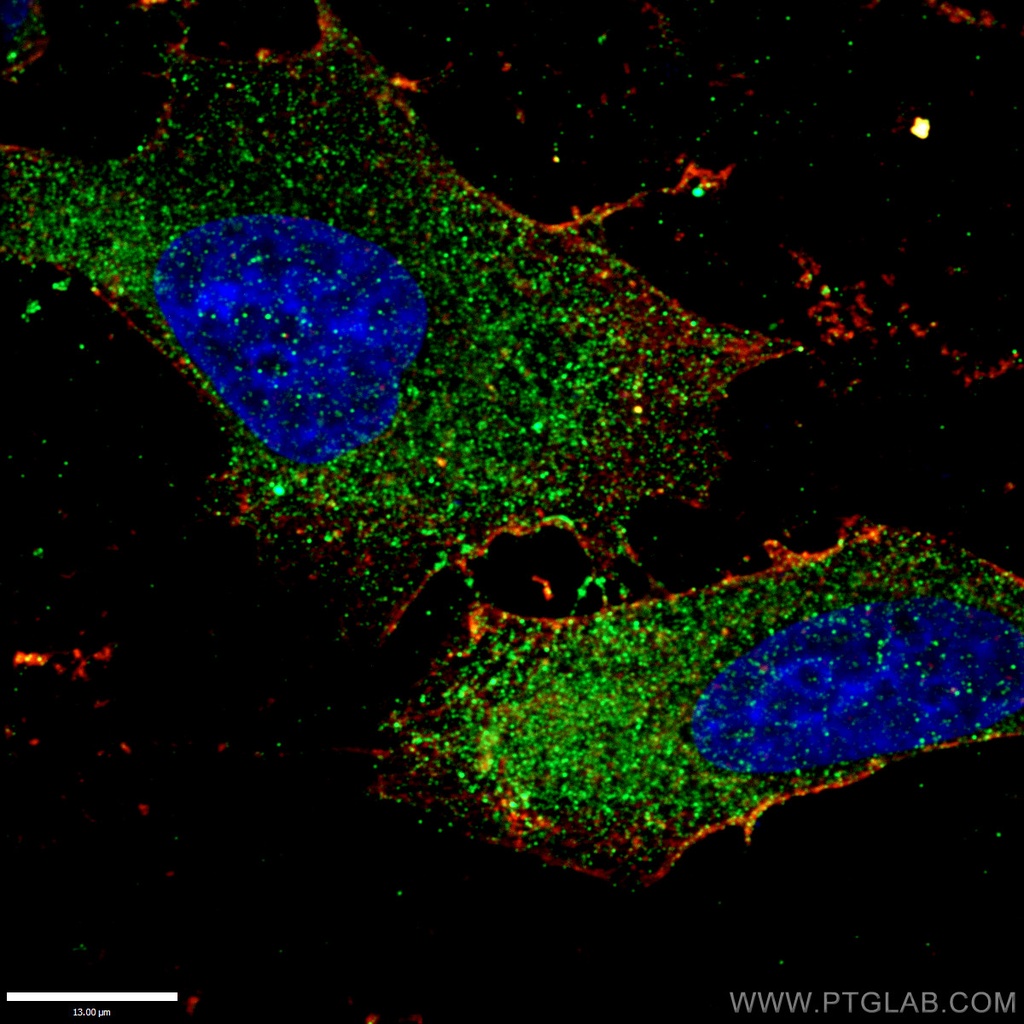PEX1 Polyclonal antibody