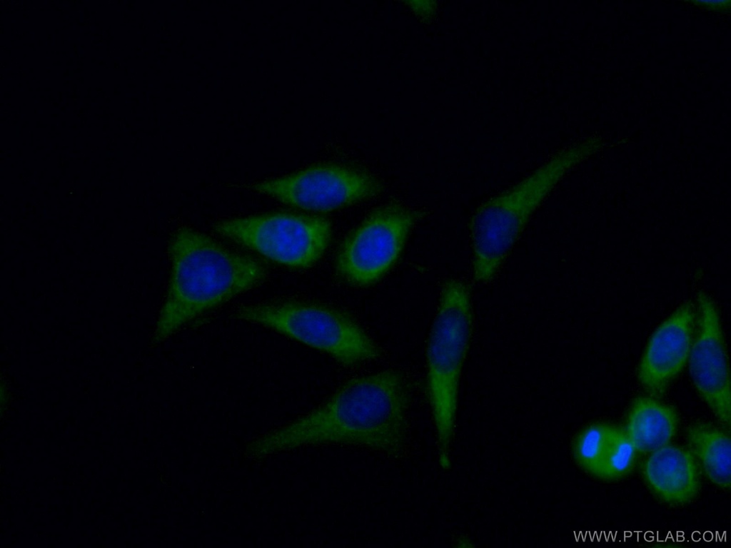 SEC24D Polyclonal antibody