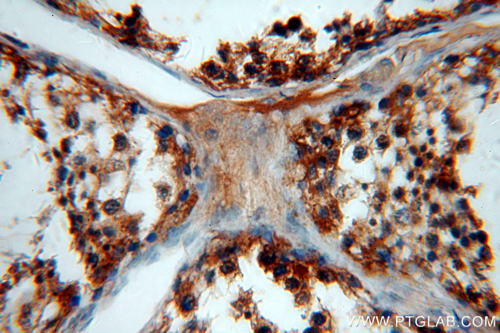 WDR1 Polyclonal antibody