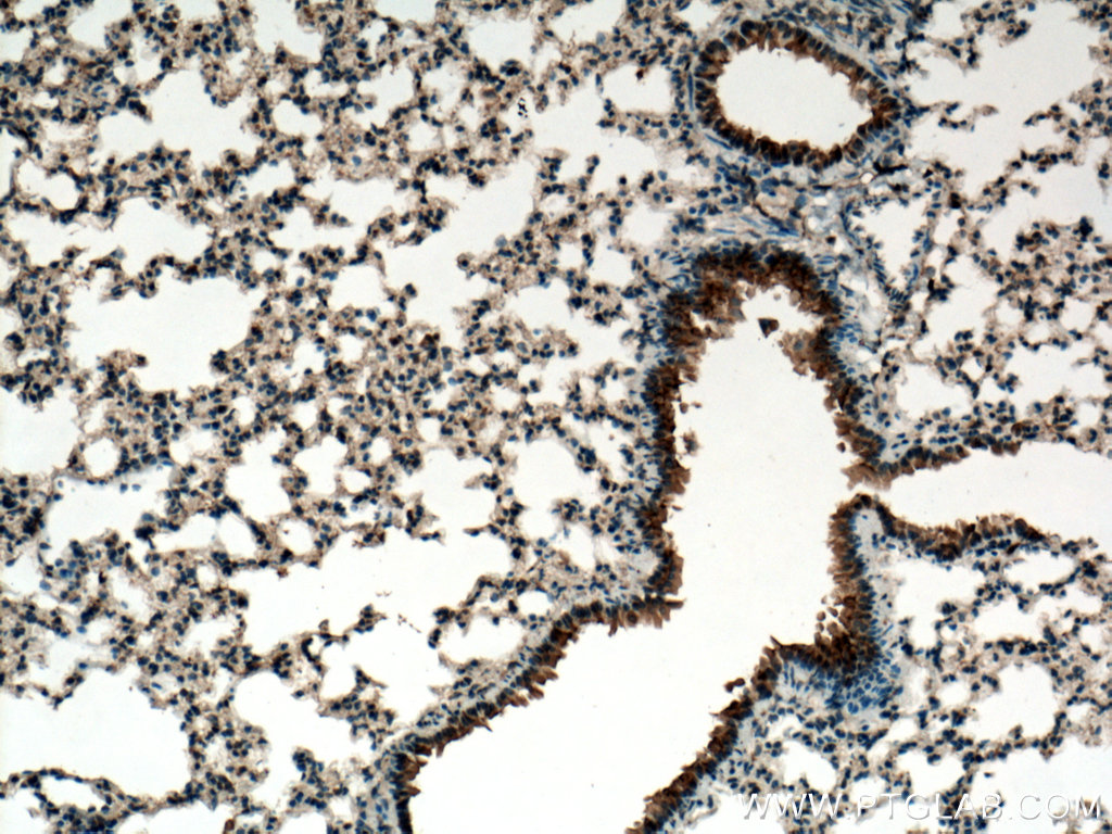 PIGA Polyclonal antibody
