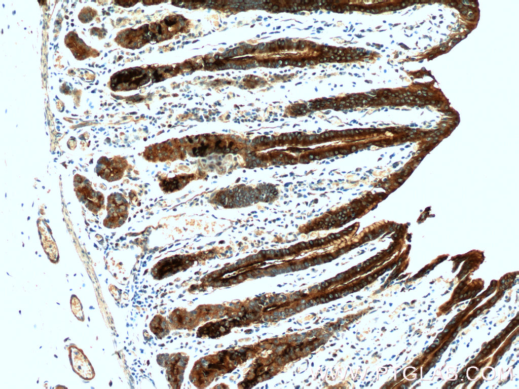 TFF2 Polyclonal antibody