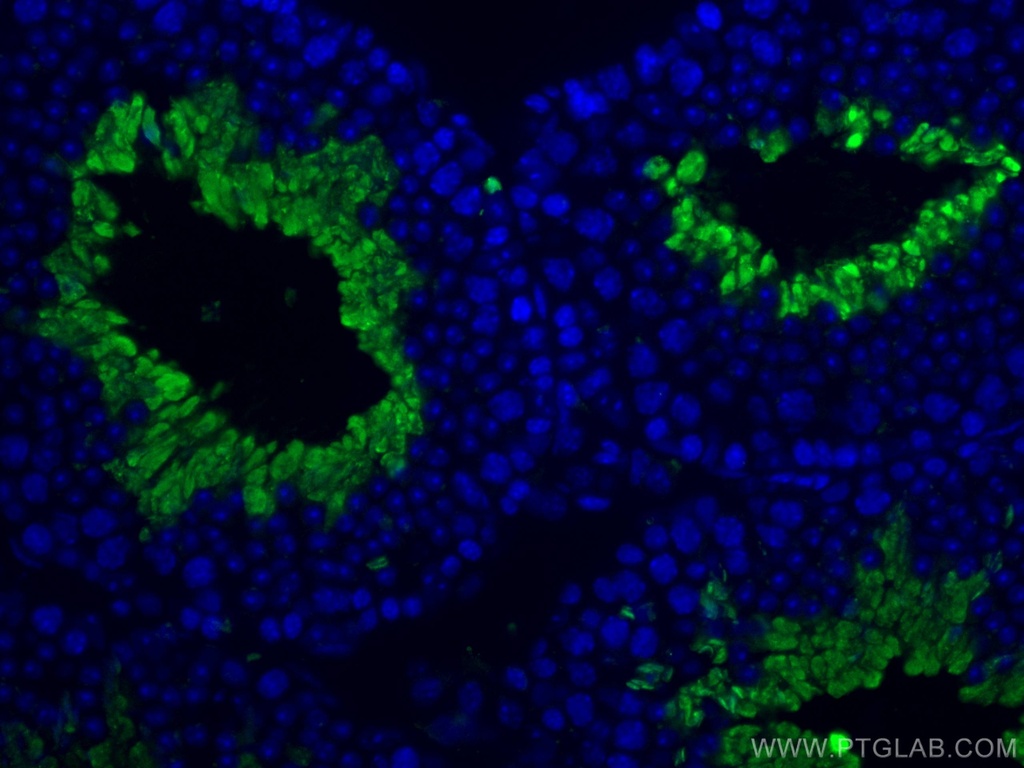 PGK2 Polyclonal antibody