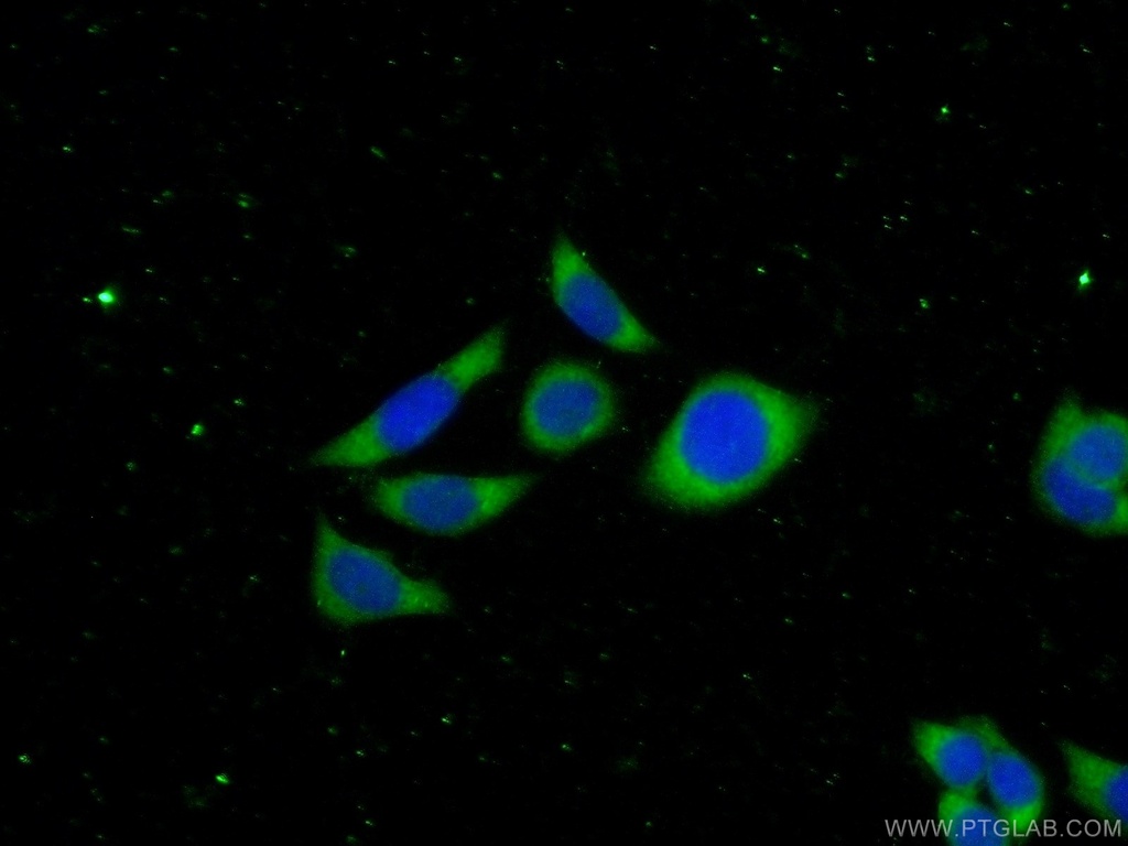 NEDD4L Polyclonal antibody