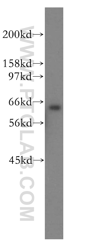 SSX2IP Polyclonal antibody