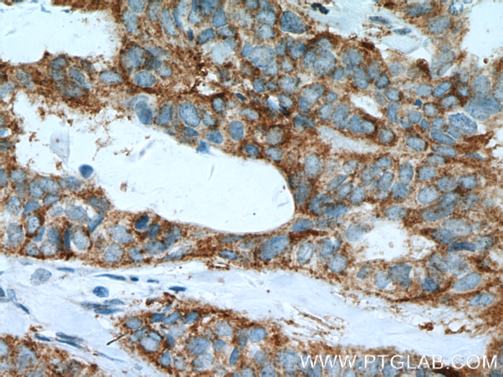 FMO5 Polyclonal antibody