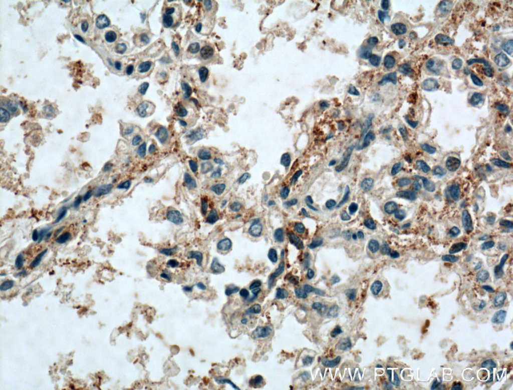 SCARF1 Polyclonal antibody