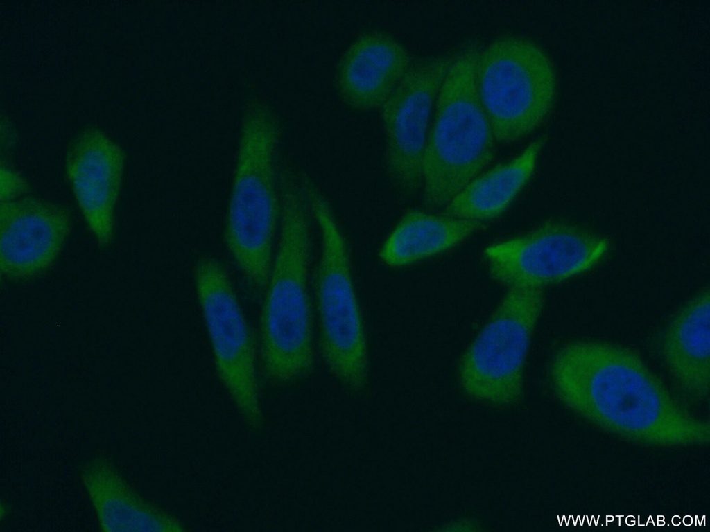 LARP1 Polyclonal antibody