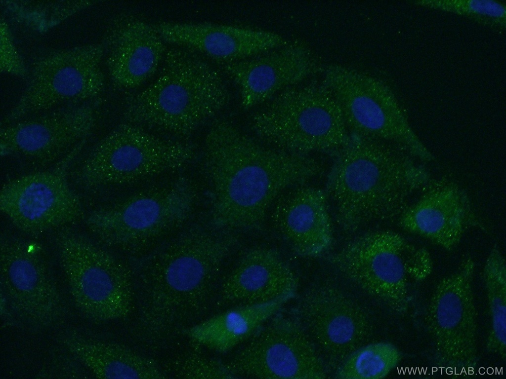 Carboxypeptidase E Polyclonal antibody