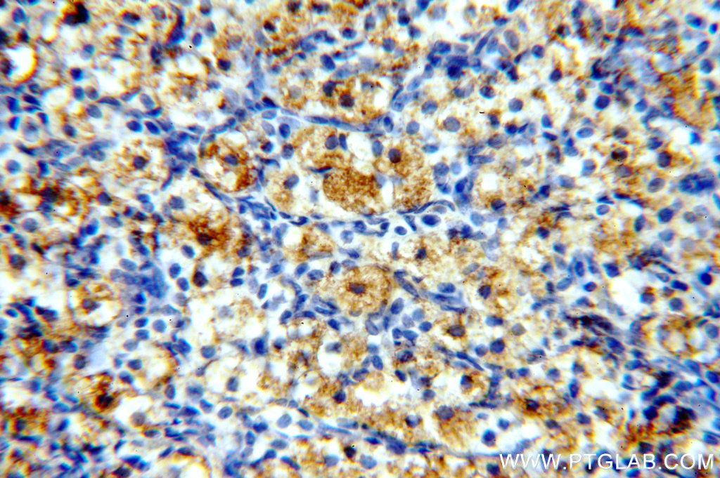 PNCK Polyclonal antibody