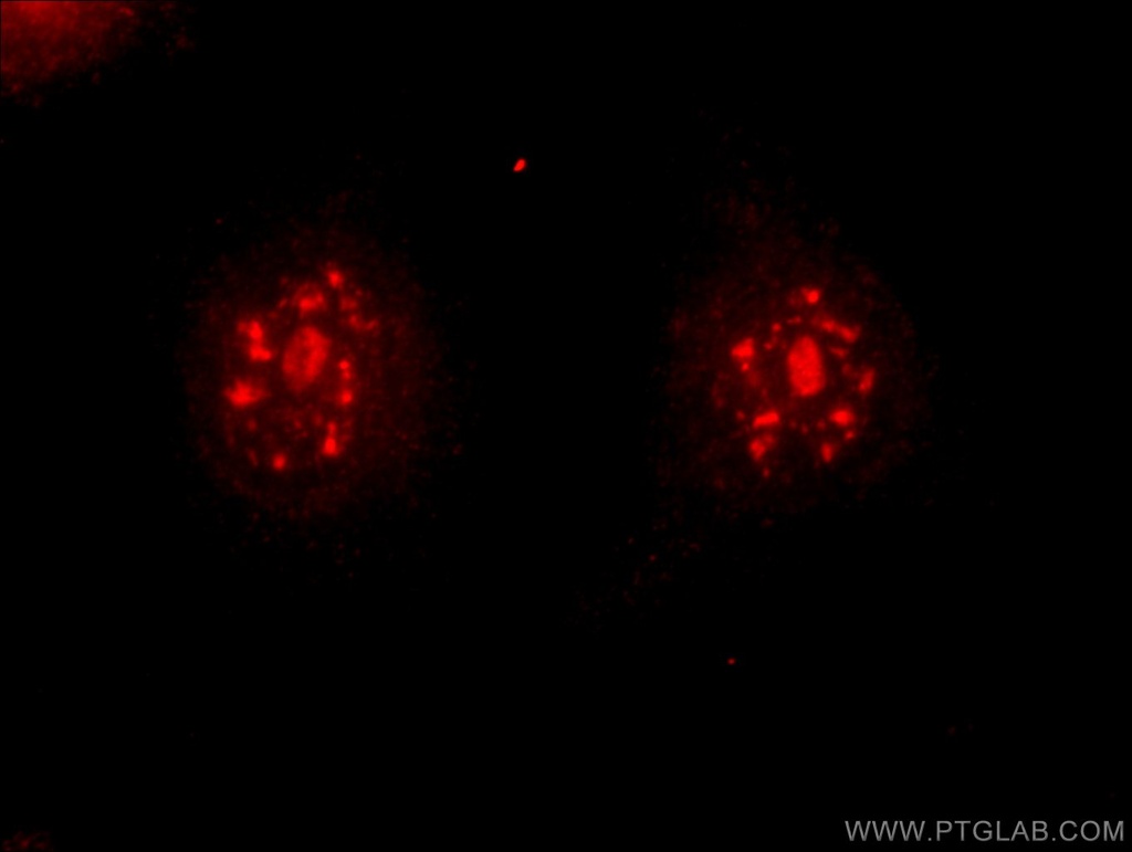 DMC1 Polyclonal antibody