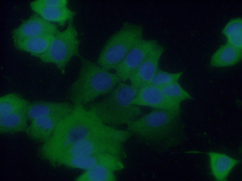 CCDC6 Polyclonal antibody