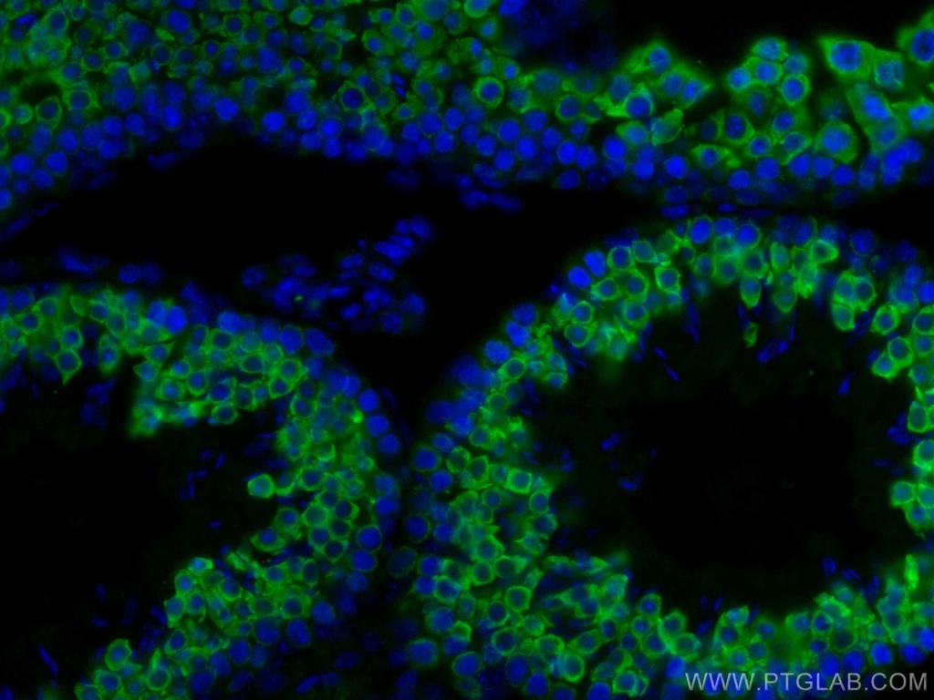 BOULE Polyclonal antibody