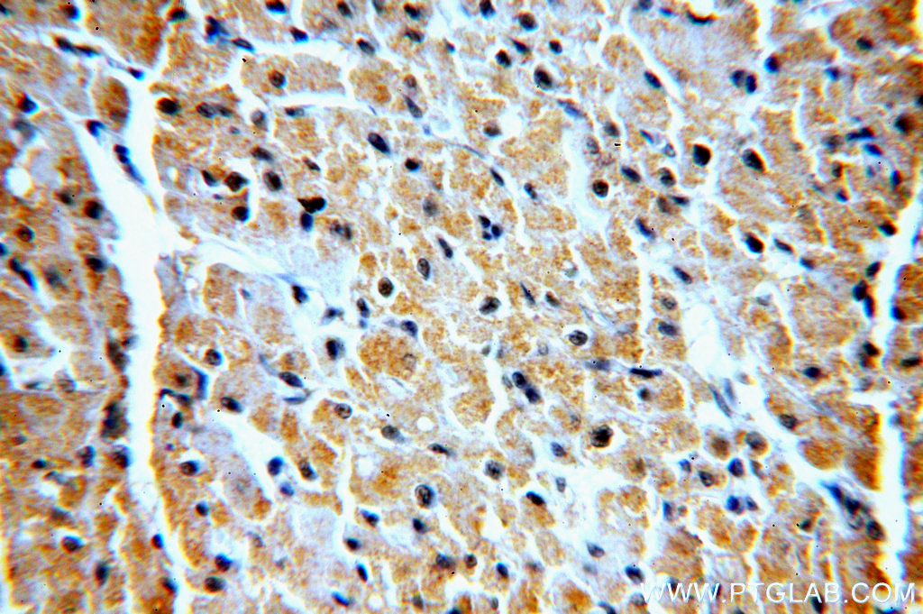 VPS34 Polyclonal antibody