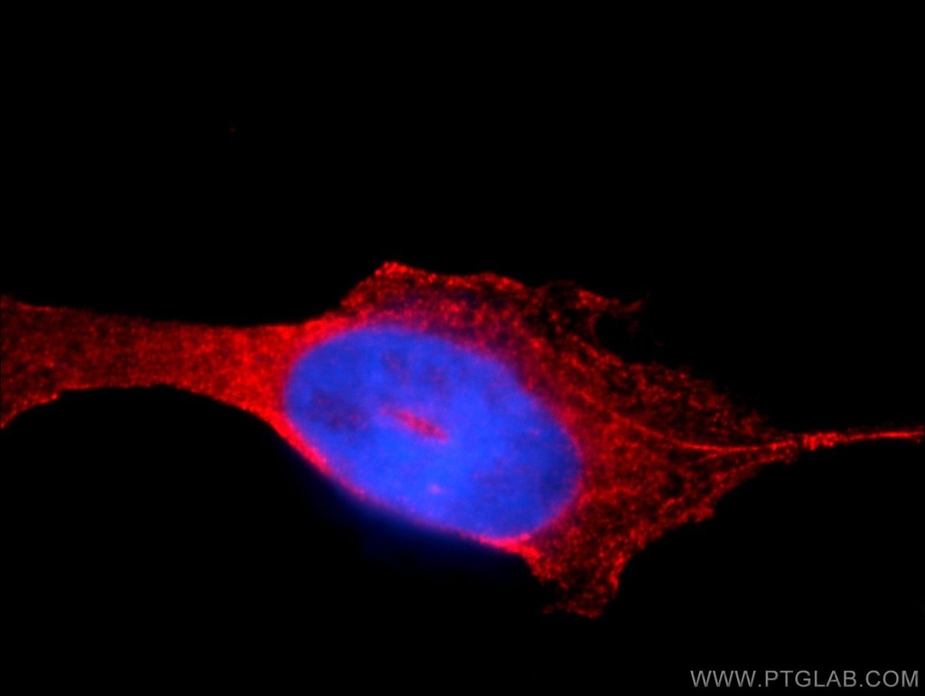 AUP1 Polyclonal antibody