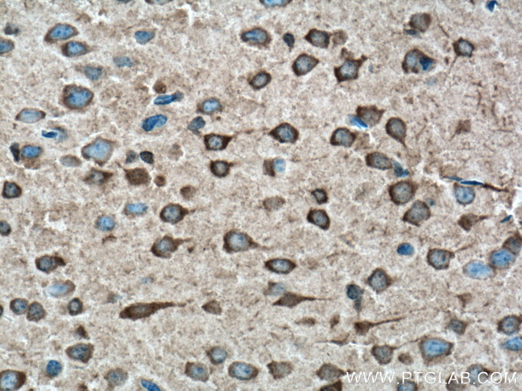 GRK3 Polyclonal antibody