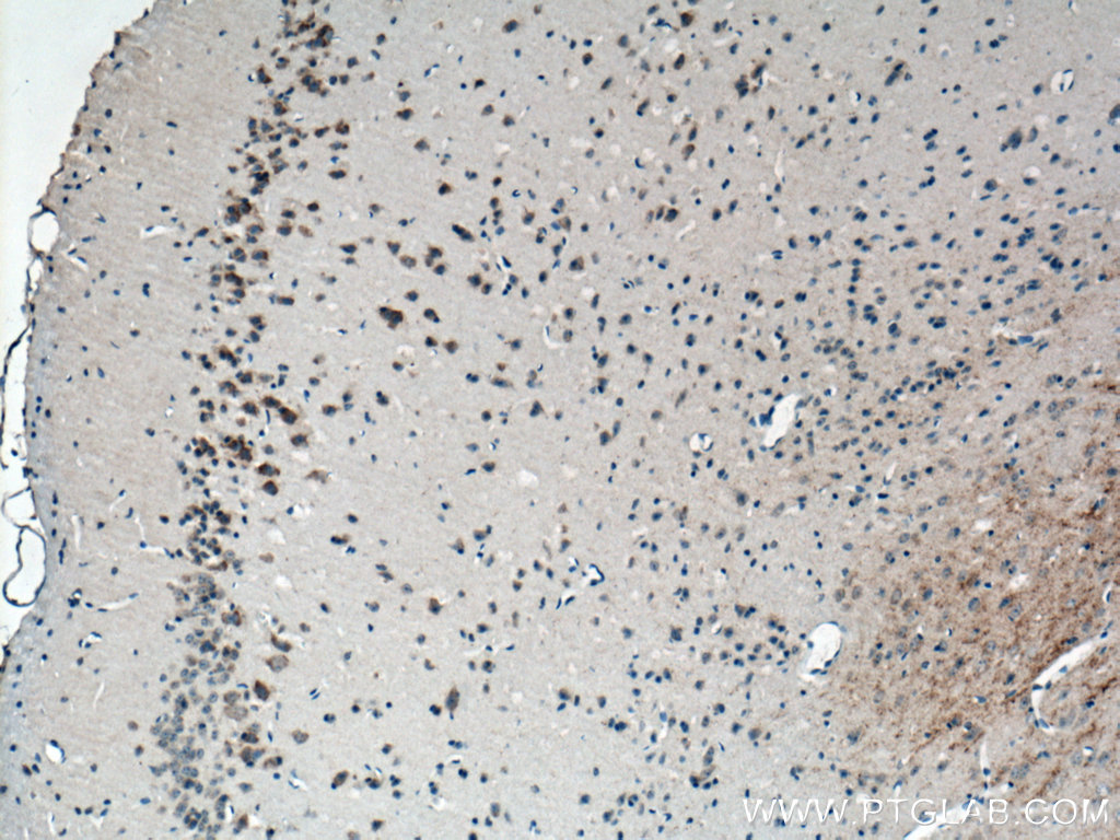 CACNG3 Polyclonal antibody